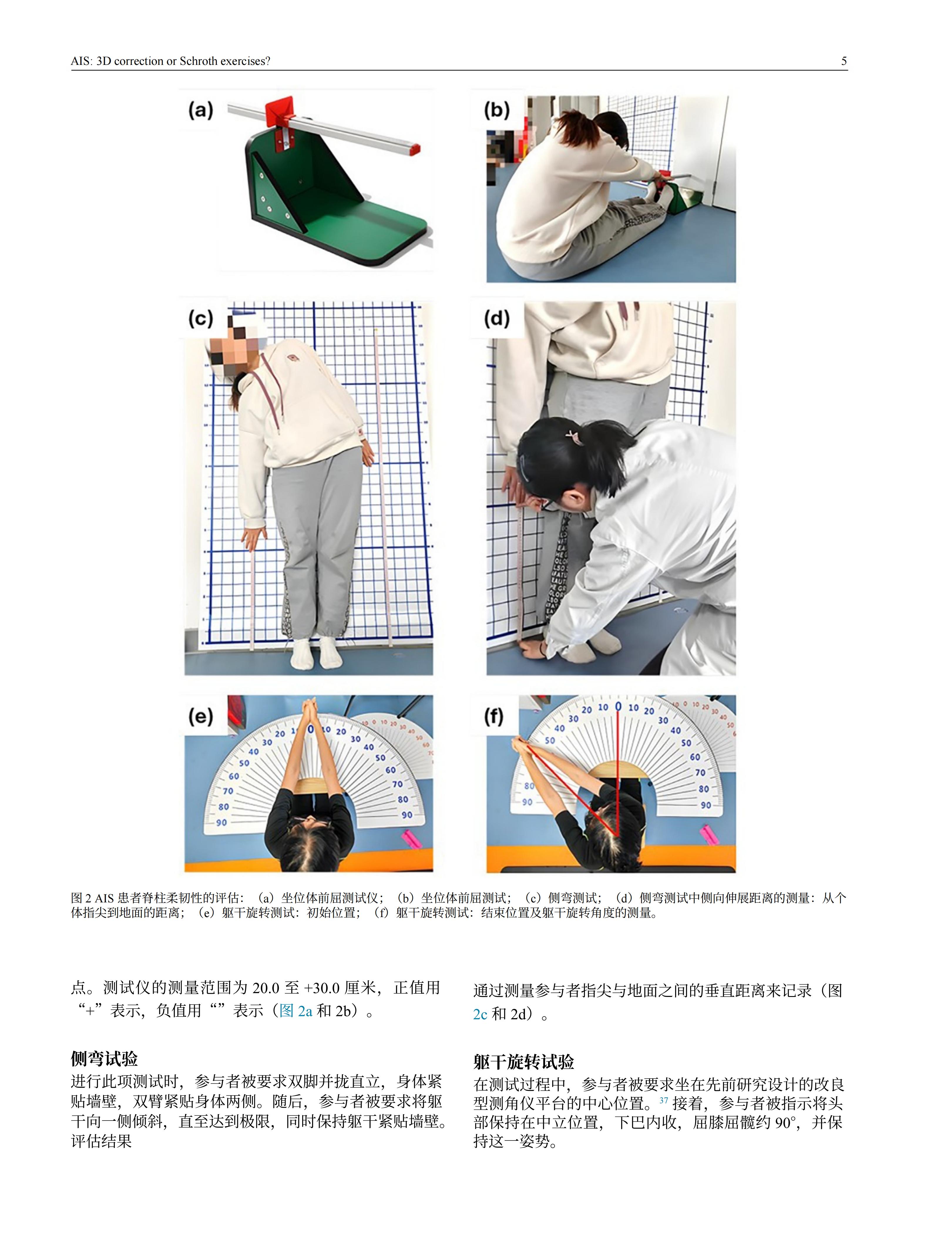 青少年特發(fā)性脊柱側(cè)彎患者采用先進機械三維脊柱側(cè)彎矯正方案的效果